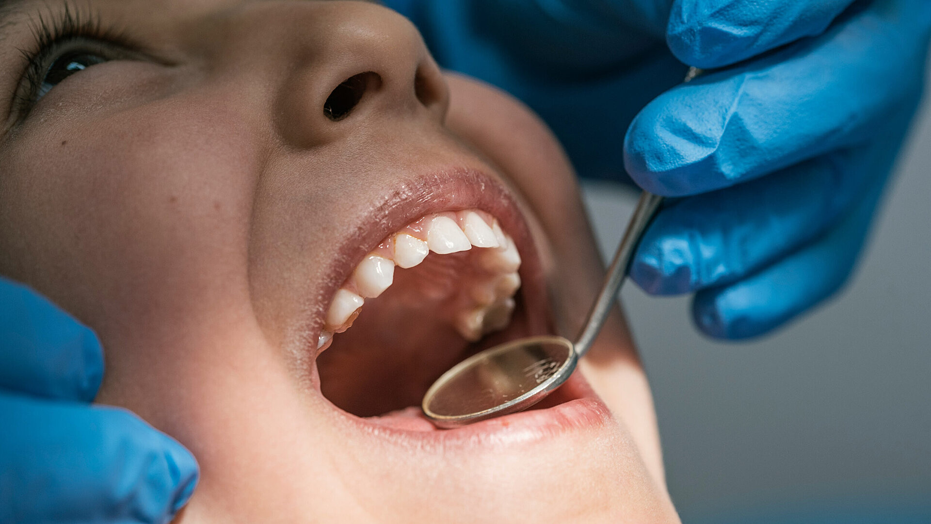 Zahngold: Warum sich eine professionelle Bewertung lohnt – und worauf man achten sollte Zahngold: Warum sich eine professionelle Bewertung lohnt – und worauf man achten sollte - Behandlung beim Zahnarzt